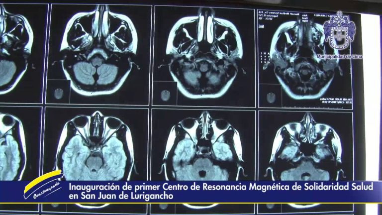 Descubre cómo obtener una resonancia magnética al mejor precio en Perú: Guía completa